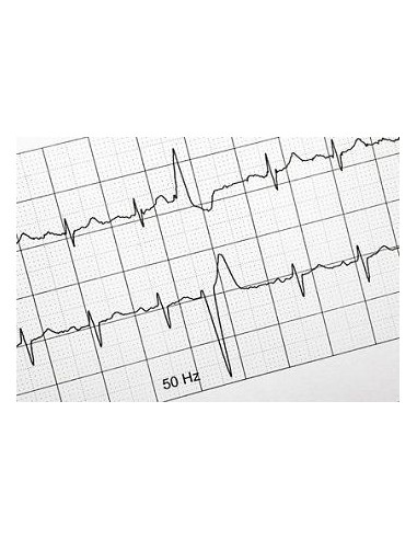 Papel ECG rollo Cardiorapid 60x15 10u